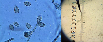 Bào tử nấm Pyricculari Cavara gây bệnh đạo ôn