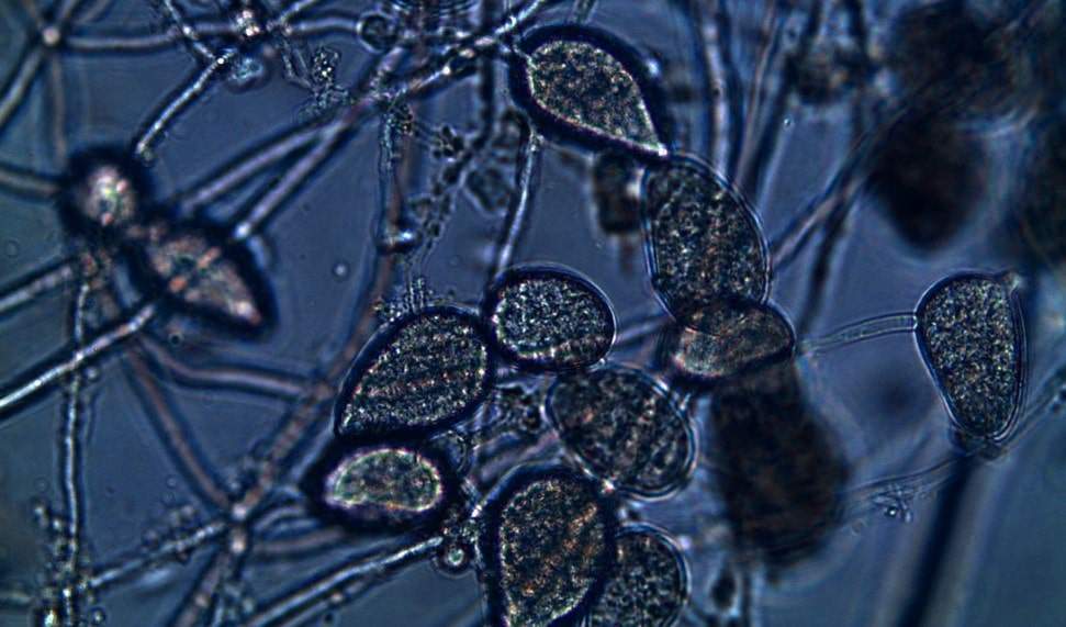 Bào tử nấm Phytophthora infestans gây bệnh sương mai cà chua