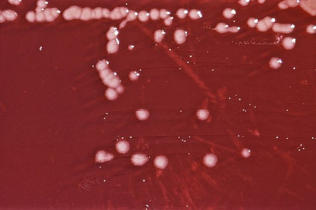 Vi khuẩn Pseudomonas