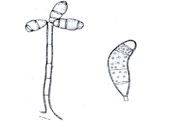 Cành bào tử và bào tử nấm Curvularia lunata