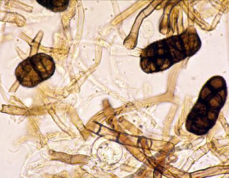Hình 4. Hình dạng của nấm Stemphylium solani