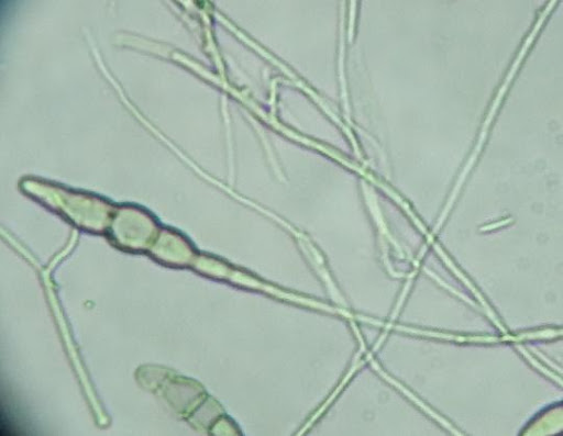Hình 3. Alternaria adwickii