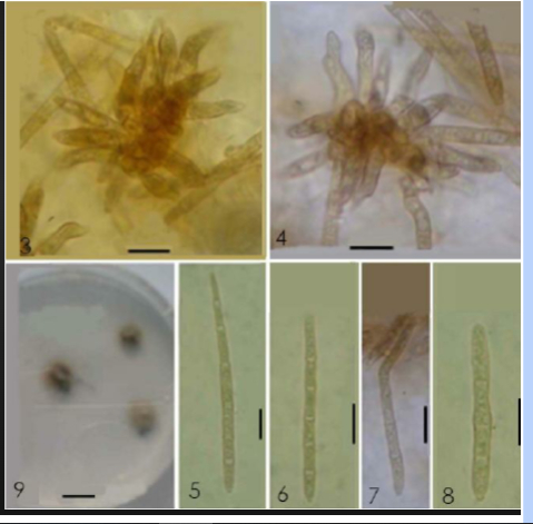 Hình 3. Hình dạng nấm bệnh dưới kính hiển vi