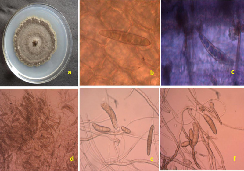 Tác nhân nấm  Helminthosporium maydis Nisikado gây bệnh đốm lá nhỏ