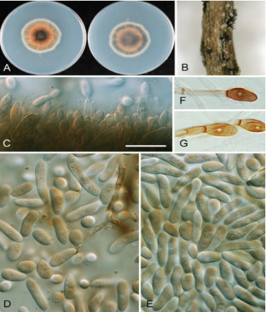 Hình 3. Hình dạng nấm bệnh dưới kính hiển vi