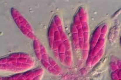 Hình 2: Nấm gây bệnh