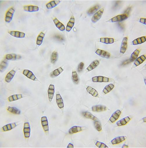 Hình 3. Bào tử nấm Pestalotia funerea