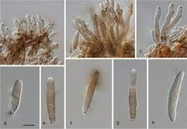 Hình 1: Loại nấm Nothopassalora personata ở bệnh đốm lá sớm