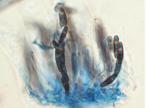 Hình 3. Hình dạng nấm bệnh dưới kính hiển vi