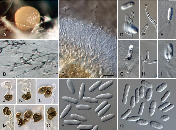 Hình 2: Nấm gây bệnh