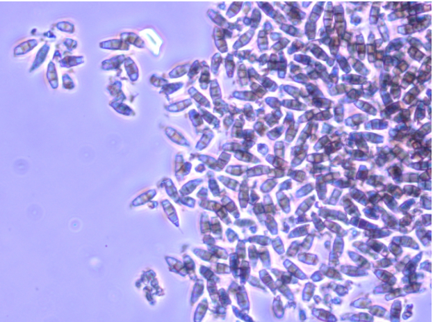 Hình 3. Hình dạng nấm bệnh Pestalozzia palmarum