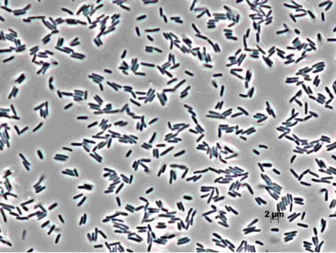 Hình 3: Một ổ vi khuẩn Pseudomonas savastanoi dưới kính hiển vi