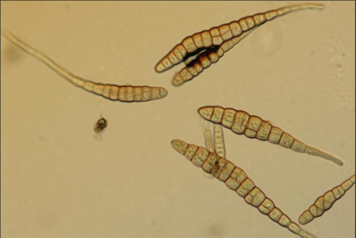 Hình 2. Hình dạng nấm bệnh dưới kính hiển vi