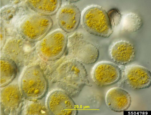 Hình 2. Hình dạng nấm bệnh dưới kính hiển vi