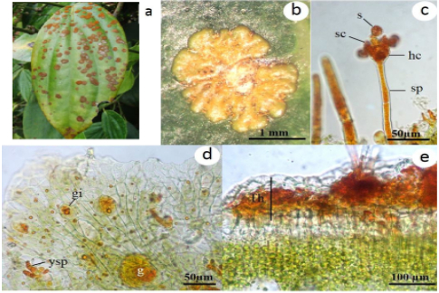 Hình 3: Bào tử nấm tảo Cephaleuros virescens dưới kính hiển vi
