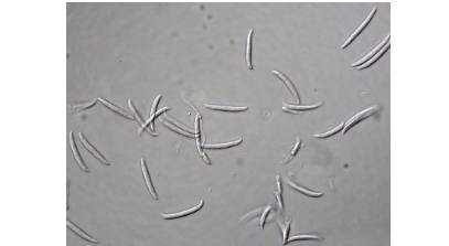 Hình 3. Fusarium oxysporum