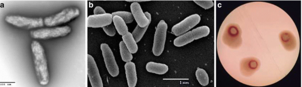 Hình 3. Hình ảnh vi khuẩn Pseudomonas solanacearum dưới kính hiển vi