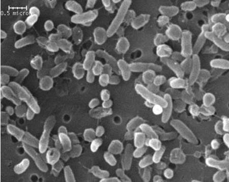 Hình 3. Hình ảnh vi khuẩn họ Pseudomonas solanacearum