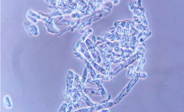 Hình 3. Hình dạng nấm bệnh dưới kính hiển vi