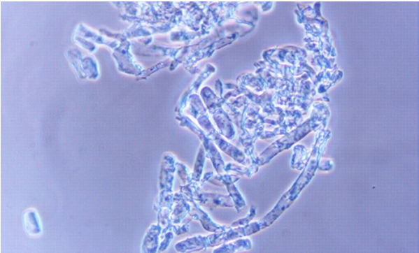 Hình 2. Mô hình nấm gây bệnh phấn trắng