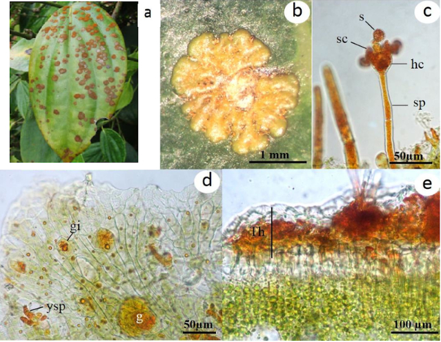 Hình 3: Bào tử nấm tảo Cephaleuros virescens dưới kính hiển vi