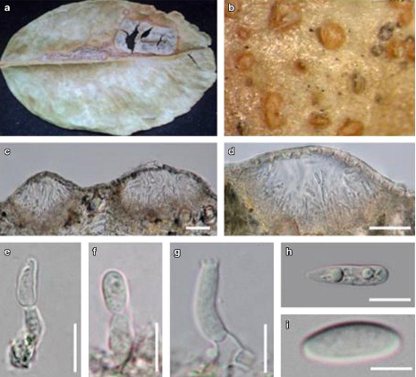 Hình 2: Nấm gây bệnh