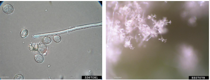 Hình 4. Hình ảnh nấm Peronospora manshurica (Naumov) Sydow
