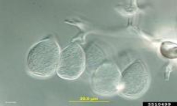 Hình 3. Nấm Plasmopara viticola dưới kính hiển vi