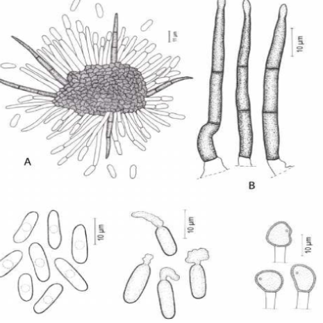 Hình 2. Hình dạng nấm bệnh dưới kính hiển vi