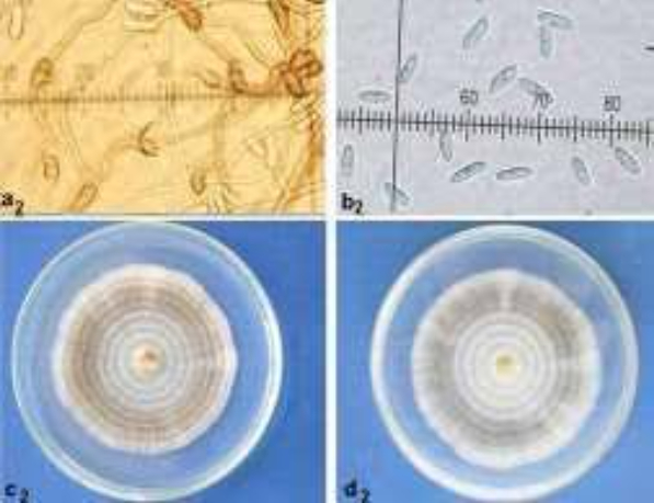 Hình 3. Hình dạng nấm Colletotrichum gloeosporioides