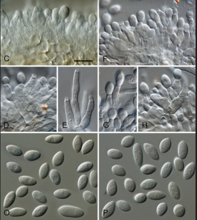 Hình 2. Nấm Colletotrichum chrysanthemi Saw