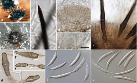 Hình 3. Hình ảnh nấm nấm Colletotrichum truncatum