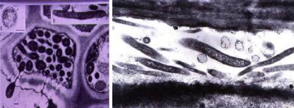 Hình 4: Vi khuẩn Liberibacter phát triển mạnh ở 20 - 35°C