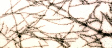 Hình 4. Papaya Ringspot Virus (PRSV)