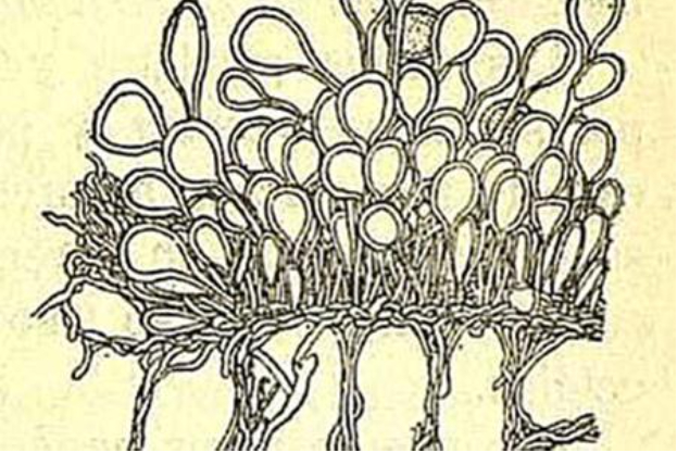 Hình 4. Bào tử của nấm Melampsora liniperda Palm
