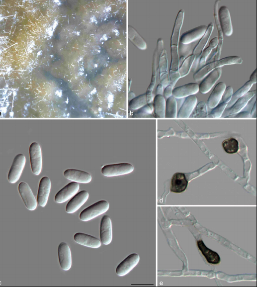 Hình 2. Nấm Colletotrichum gloeosporioides