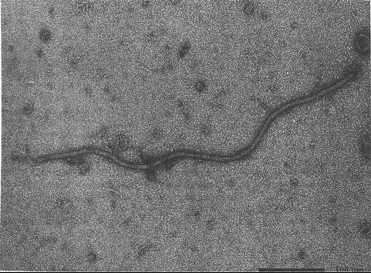Hình 2. Hình ảnh Maize dwarf mosaic virus (DMV)