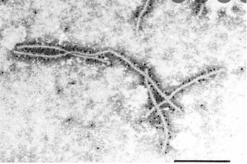 Hình 2. Hình ảnh virus Sweet potato feathery mottle virus (SPFMV)